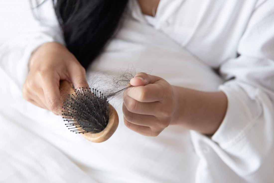 Hair Loss after Bariatric Surgery