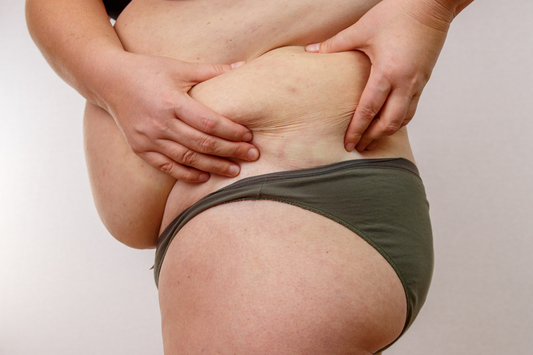 Complications of Bariatric Surgery