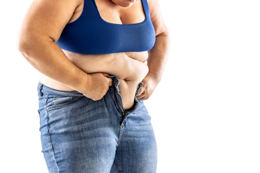 Alternative of Bariatric Surgery