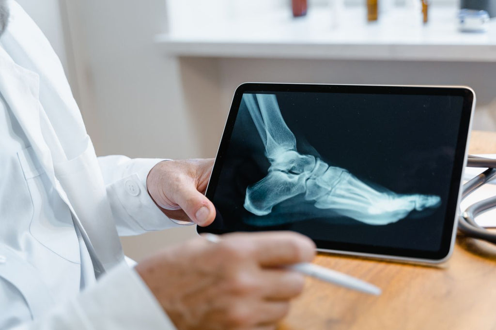 Bariatric Surgery and Bone Health: Why Calcium and Vitamin D Matter Long-Term