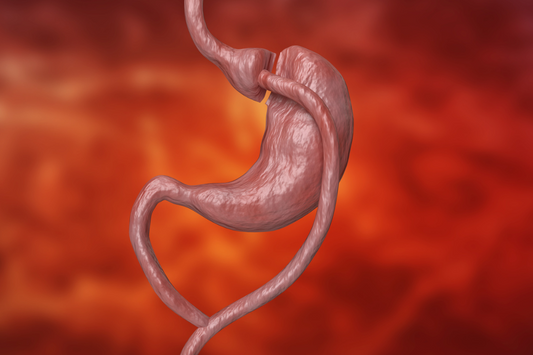 Can Gastric Bypass Be Reversed