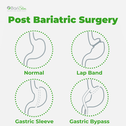 Post bariatric surgery - Barislim