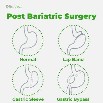 Post Bariatric Surgery - lap band, gastric sleeve and gastric bypass